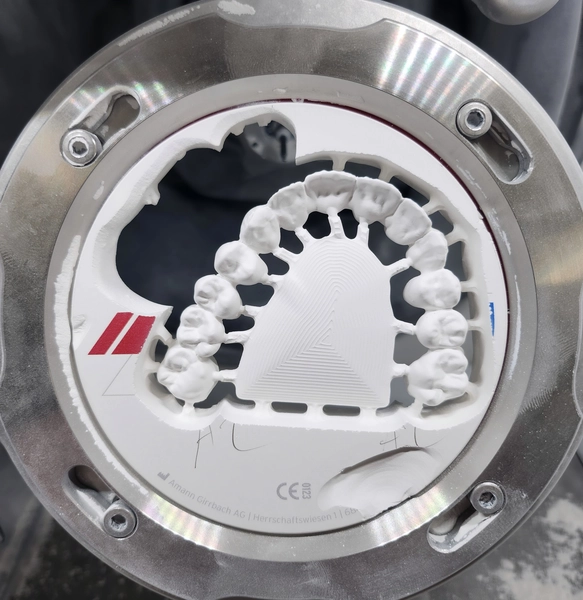 R&V Qualitätszahntechnik - Dentallabor - ein gegossenes Metallgerüst für eine herausnehmbare Teilprothese,